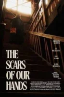Шрамы на наших руках